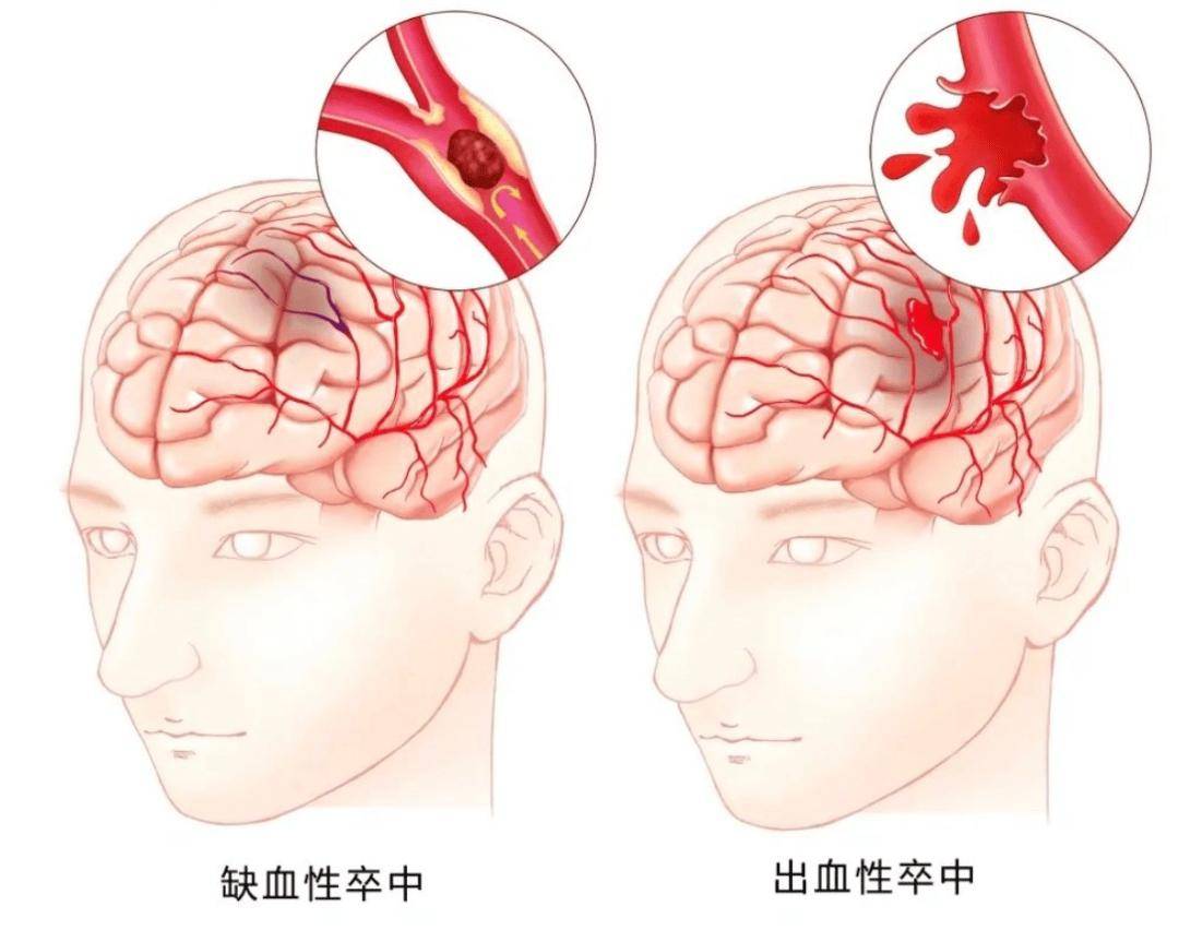 澳門最精準正最精準龍門,開學季，請收好這份健康提示